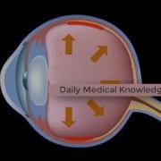 Development Of Glaucoma Animation Open Angle Vs Angle Closure Glaucoma