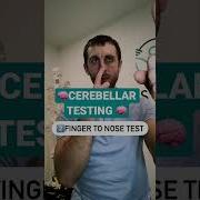 Cerebellar Coordination Testing Shorts