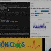 Enhancing EEG Data Visualization Web App Development Journey