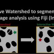 Interactive Watershed To Segment Objects For Image Analysis Using Fiji ImageJ