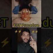 ECT Procedure
