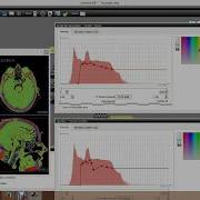 Outstanding Volume Visualization Software Demonstration By Anton Chulkov