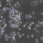 Multi Target Tracking Of Cells Using The GMPHD Filter