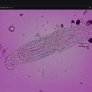 OpenFlexure Microscope 40X Objective