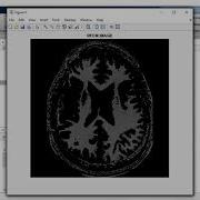ROBUST IMAGE SEGMENTATION ALGORITHM USING FUZZY CLUSTERING BASED ON KERNEL INDUCED DISTANCE MEASURE