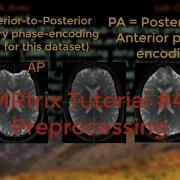 MRtrix Tutorial 4 Preprocessing
