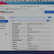 MNE Python Feature Spotlight Reports