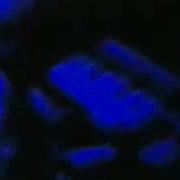 Led Zeppelin No Quarter Live 1973 Best Audio Mix