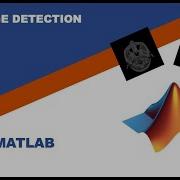Matlab Edge Detection