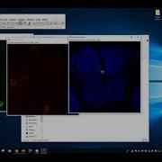 ImageJ For Beginner I