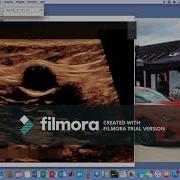 Tutorial ImageJ Image Processing