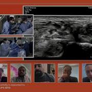 Use Of IVUS And EVUS To Enhance Your CLI Treatment Algorithm
