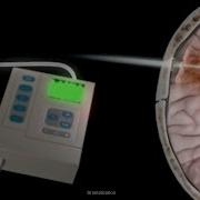 What Is Intracranial Pressure