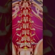 Lower Back Strain