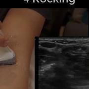 Ultrasound Probe Transducer Movements And Manipulation Made EASY