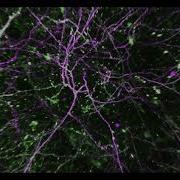 What Learning Looks Like In The Brain