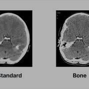 What Happens During The Reconstruction Process To Create A CT Image CT Physics