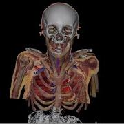 After She Died A Woman Got Sliced Up 27 000 Times For Science And Became A Visual Human