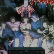 Tankard Zombie Attack