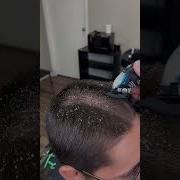 BARBER CUTS OFF LICE MUST WATCH