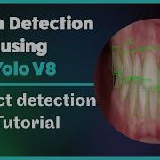 Teeth Detection Using Deep Learning Yolo V8