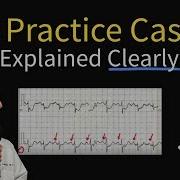 ECG EKG Practice Case 15 Step By Step Interpretation