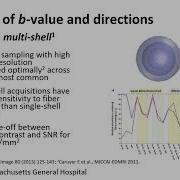 Advances In Diffusion MRI Acquisition And Connectome 2 0