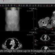MedDream DICOM Viewer The Multi Image View
