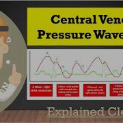 Central Venous Pressure CVP Waveform And Tracing Basics A C X V Y Explained Clearly