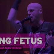 Brutal Assault 21 Dying Fetus Live 2016
