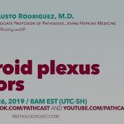 Choroid Plexus Tumors Dr Rodriguez Hopkins NEUROPATH