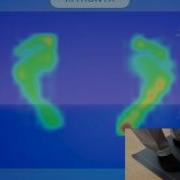 Foot Pressure Mapping Using MC1509 Force Controller And MS9711 FSR Matrix Sensor