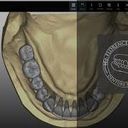 One Library Full Control Zirkonzahn Modifier