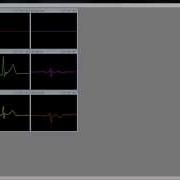 ExG For ECG EMG Shimmer Tutorial Video
