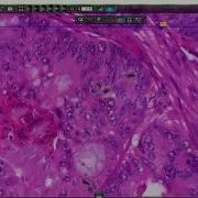 3DHISTECH Marker Counter Tracking History In CaseViewer