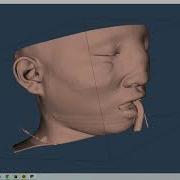VTK Python Example MedicalDemo1