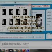 One Class Classification Of Mammograms Using Trace Transform Functionals