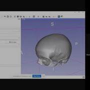 Slicer Tutorial Threshold Segmentation And Generation Of 3D Model In STL
