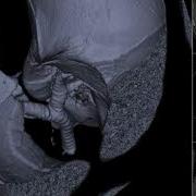 Ct Visualization Rendering Volume
