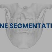 Bone Segmentation And Its Involvement With Guided Surgery Using Blue Sky Bio Software Educational