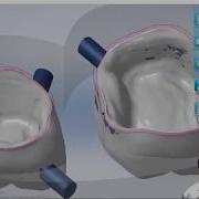 MillBox 2019 Dental Crown And Bridge Workflow SEE DESCRIPTION