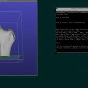 ShapeWorks Femur Use Case Option 1