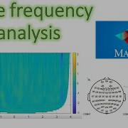 Time Frequency Analysis Of EEG Signals Part 1
