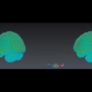 Volume Rendering And Rotation Of Human Brain 3D