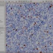 QuPath 101 Ki67 Quantification