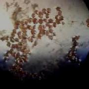 Phytoplankton Sample