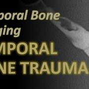 Temporal Bone Imaging Temporal Bone Fractures