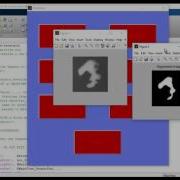 Detection And Classification Of Blood Group Using Color Image Matlab Projects
