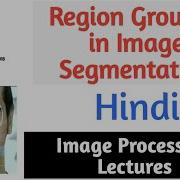 Region Growing In Image Segmentation In Hindi Image Processing Lectures