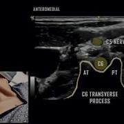 Basic Cervical Mapping Ultrasound Anatomy Review